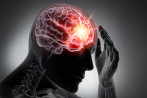 Traumatic Brain Injury —More Common Than You Think