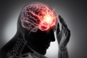 Traumatic Brain Injury