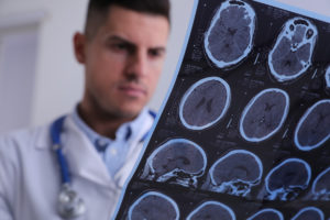 The First Steps in Diagnosing a Traumatic Brain Injury