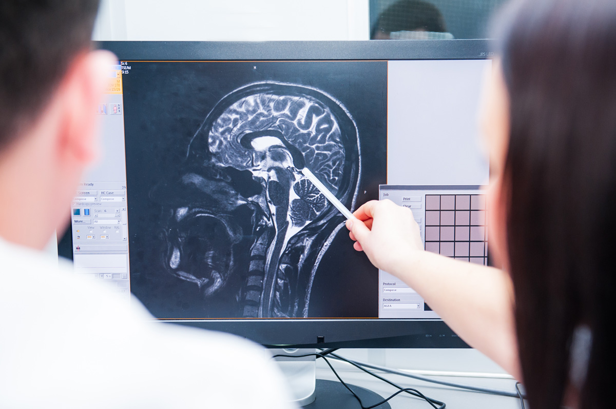 Who's Most at Risk for Traumatic Brain Injury? AdvantageHCS