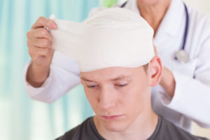 Determining the Severity of a Head Injury