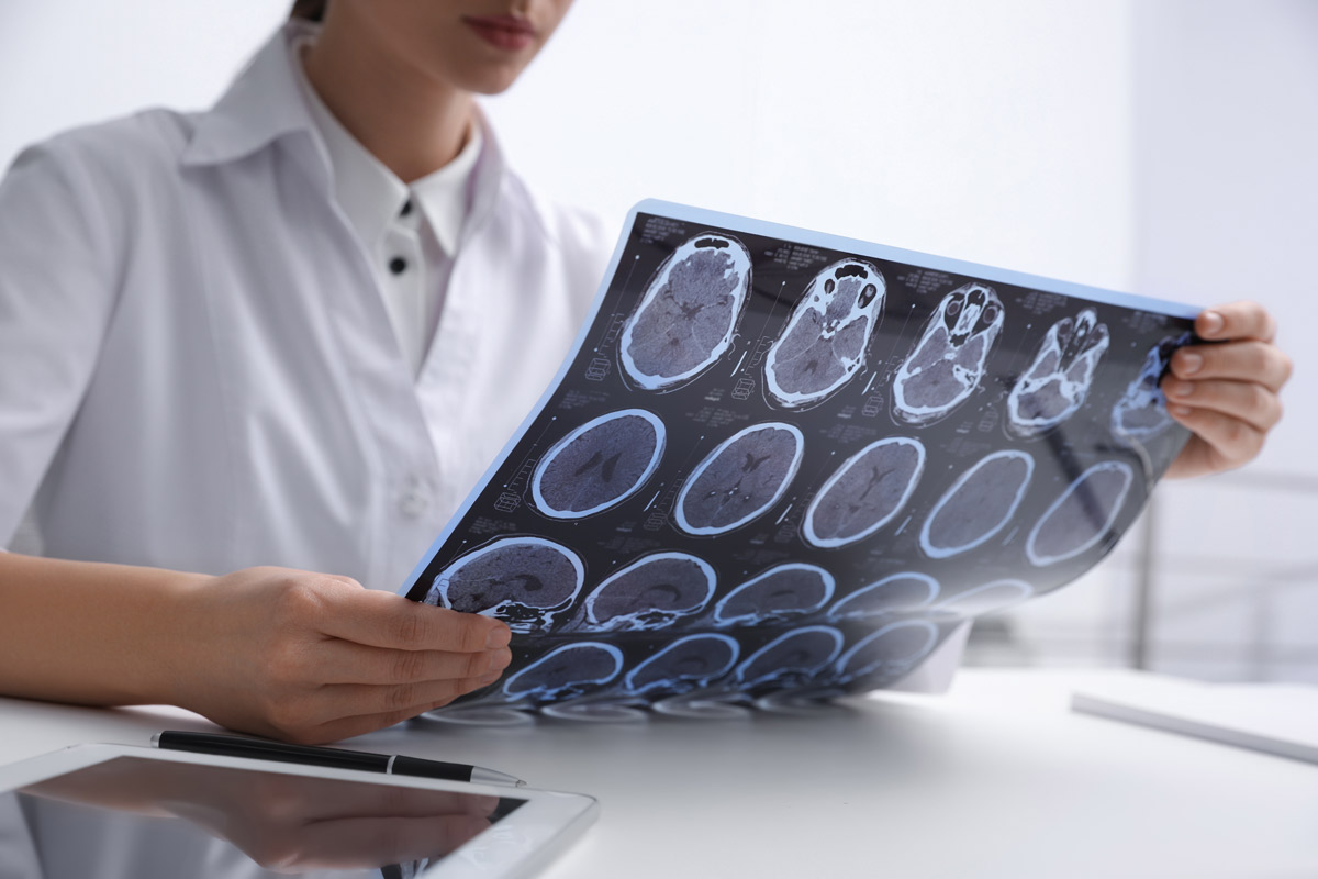 The Age-Related Risk Factors Associated with TBI - AdvantageHCS