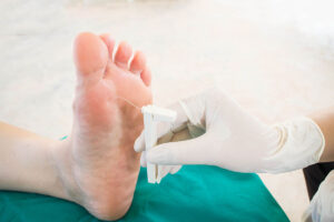 Understanding Neuropathy: Symptoms, Causes, and Treatments